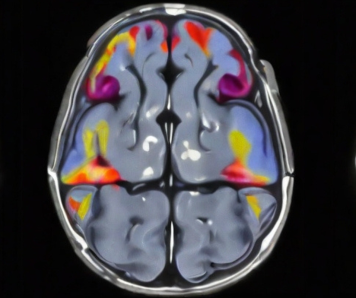 Hva sier nevrovitenskapen om sinnet?